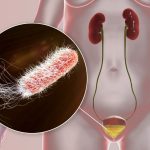 Infection urinaire : quand un besoin naturel devient un signal d’alarme